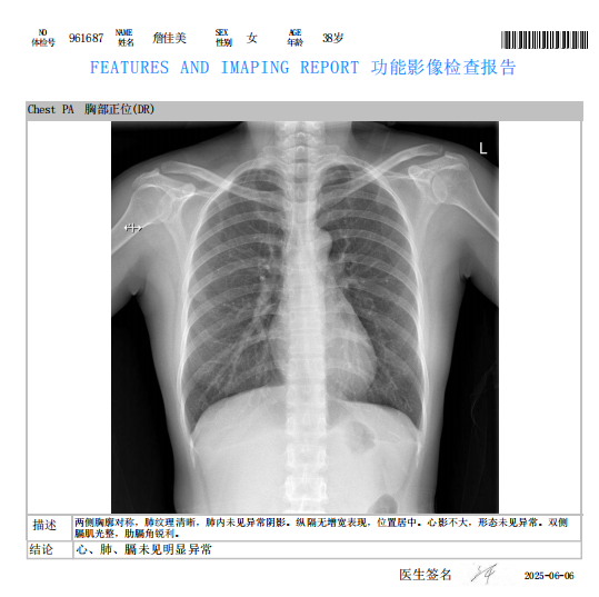 獲得其他
